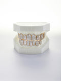 8 on 8 silver vvs moissanite full grillz (custom-fit)