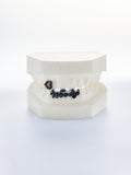silver woody style black grillz (custom-fit)
